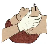 Sospecha de traumatismo cervical