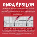 Onda Épsilon